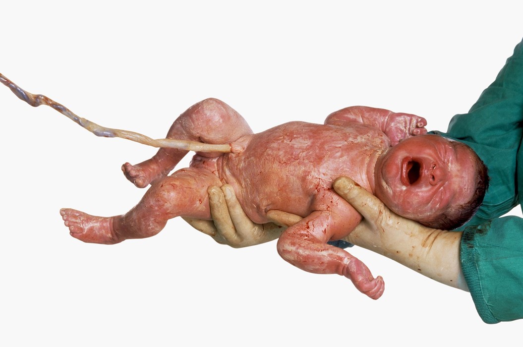 ©olivierotoscani_1991