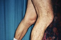 My Father’s Legs by Sara Perovic