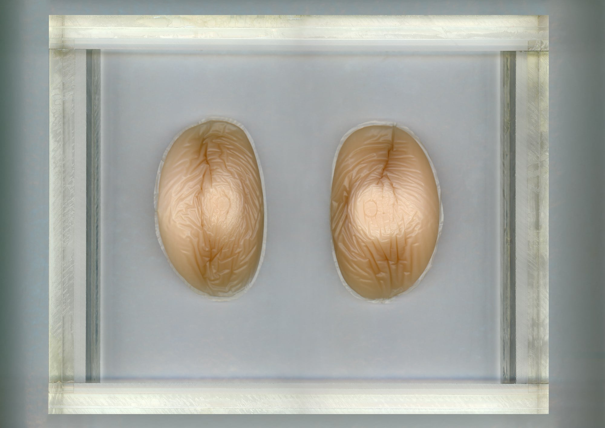 46 - SILICONE OBJECTS ENCASED IN PLEXI 