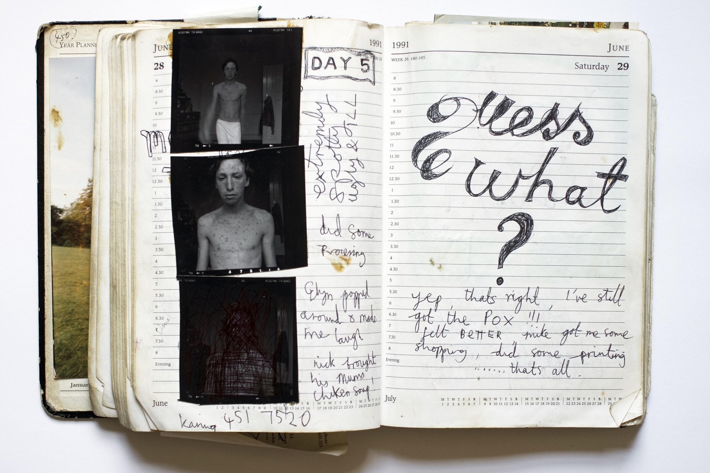 chickenpox self portrait diary page 1991