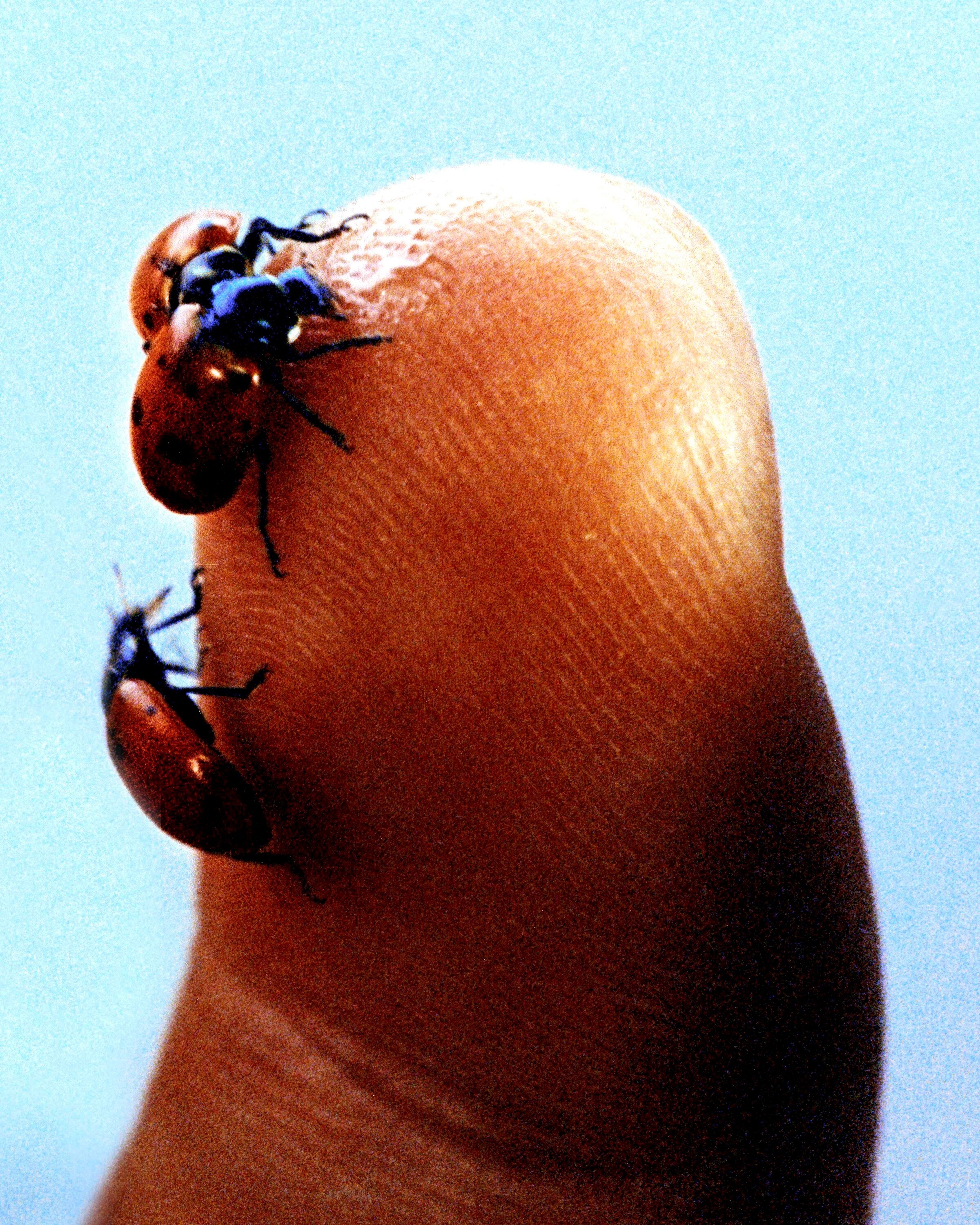 Devlin • MSA • Big Bugs