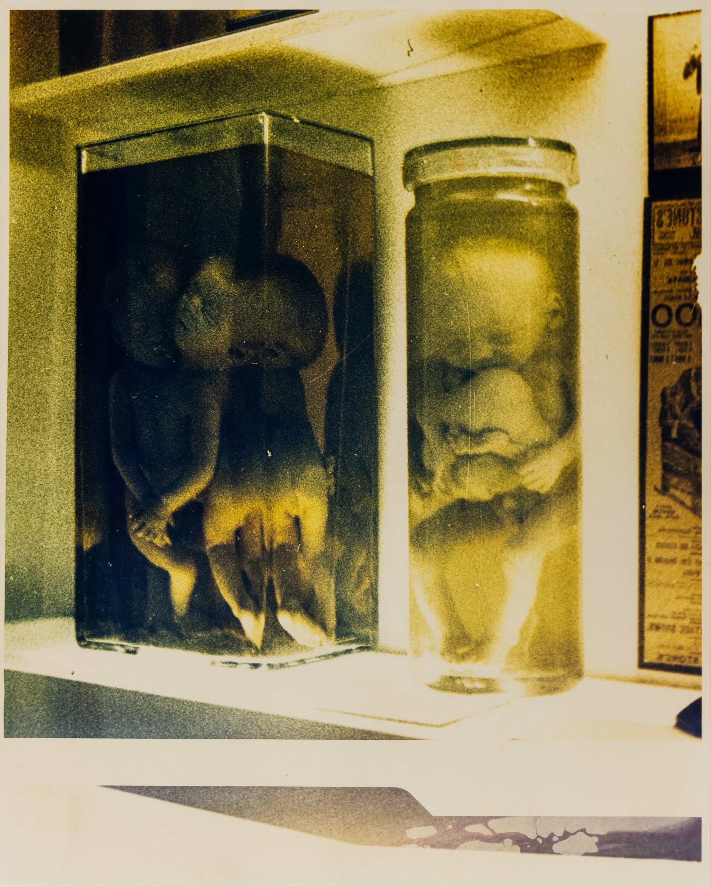 Morrisroe_Siamese Twins