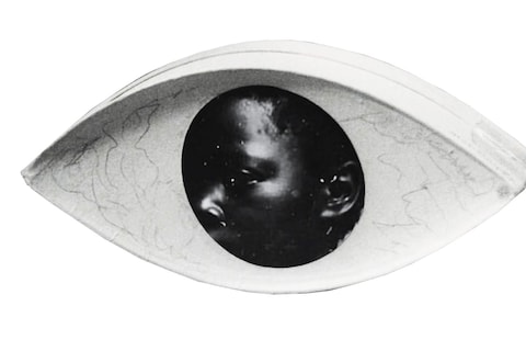 Fancy His Surprise When He Noticed That These Eyes Moved