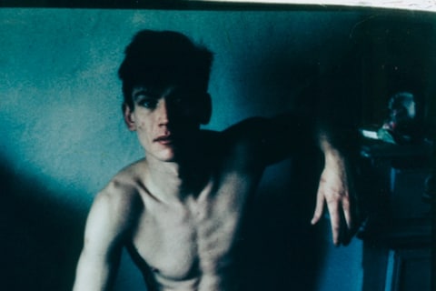 Self-Portrait With Broken Finger, Christmas 1984, 1984