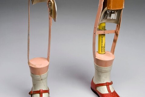 Lower limb prostheses, Roehampton, England, 1966.