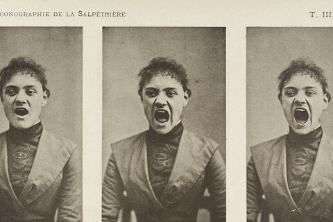 Series of three photos showing a hysterical yawning woman