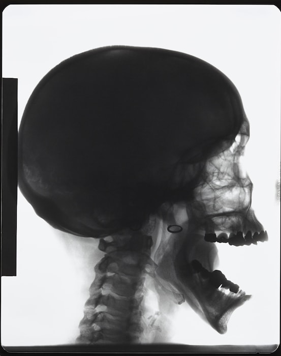 mgb16_p_genzken_03_xray