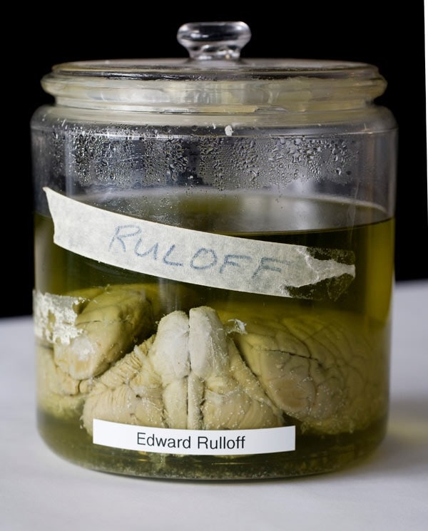 The brain of Edward H. Rulloff