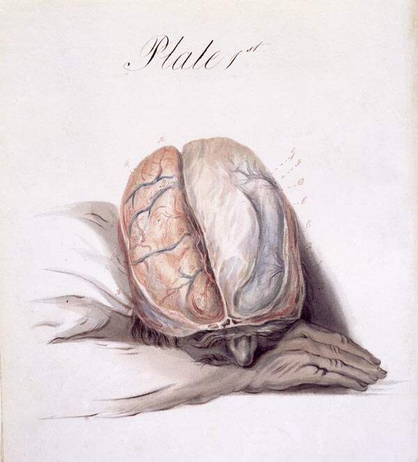 The anatomy of the brain explained in a series of plates by 