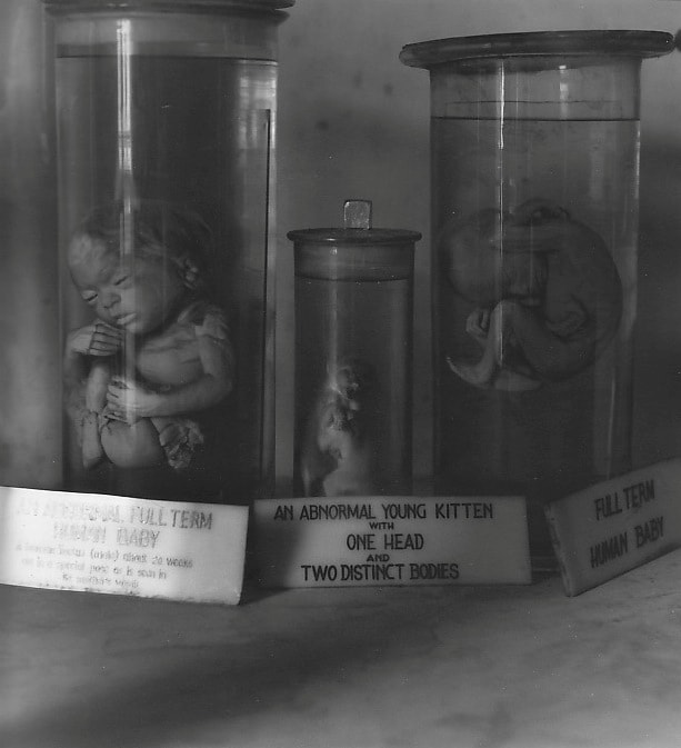 Deformed Foetuses, Indian Museum, Kolkata