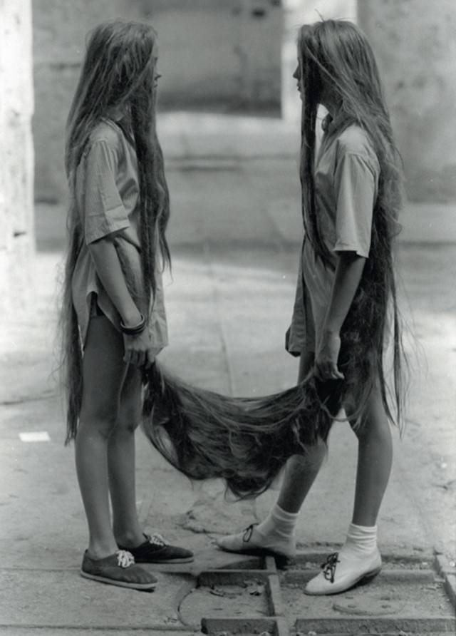 Tunga, Siamese Hair Twins, 1987