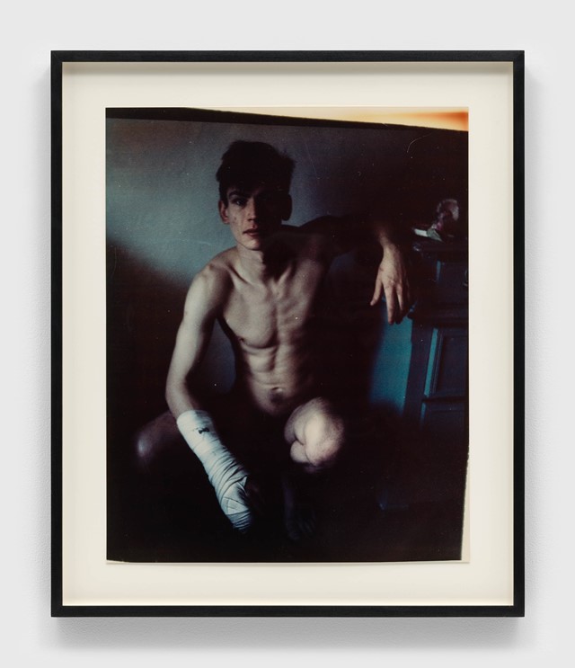 Mark Morrisroe, Self Portrait with Broken Finger, 1984