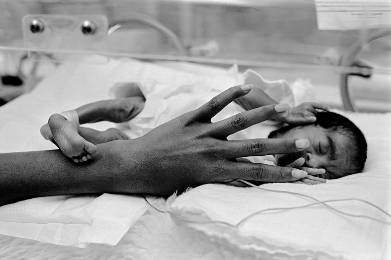 Preemie-baby-unit-at-St-Joseph’s-Hospital.-At-only