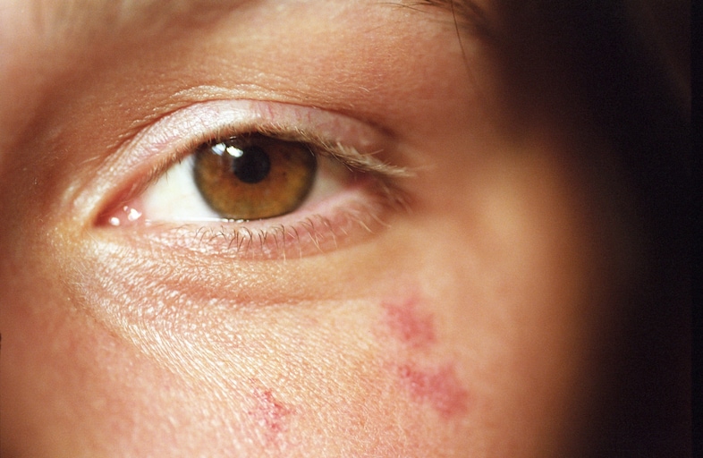 Ogen en luchten van Chad Moore