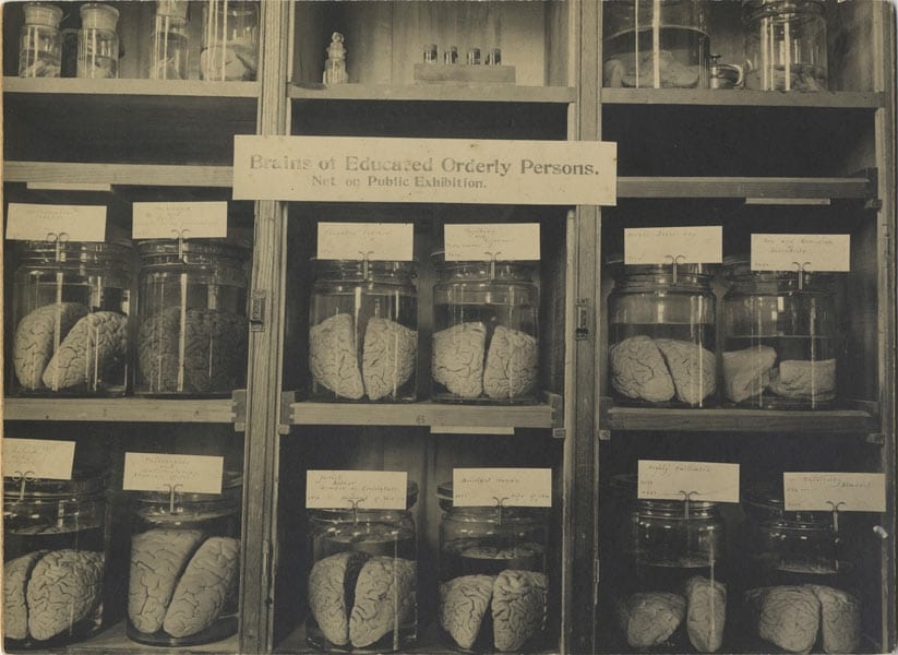 Photo cabinet of &#39;Brains of Educated and Orderly Persons&#39;