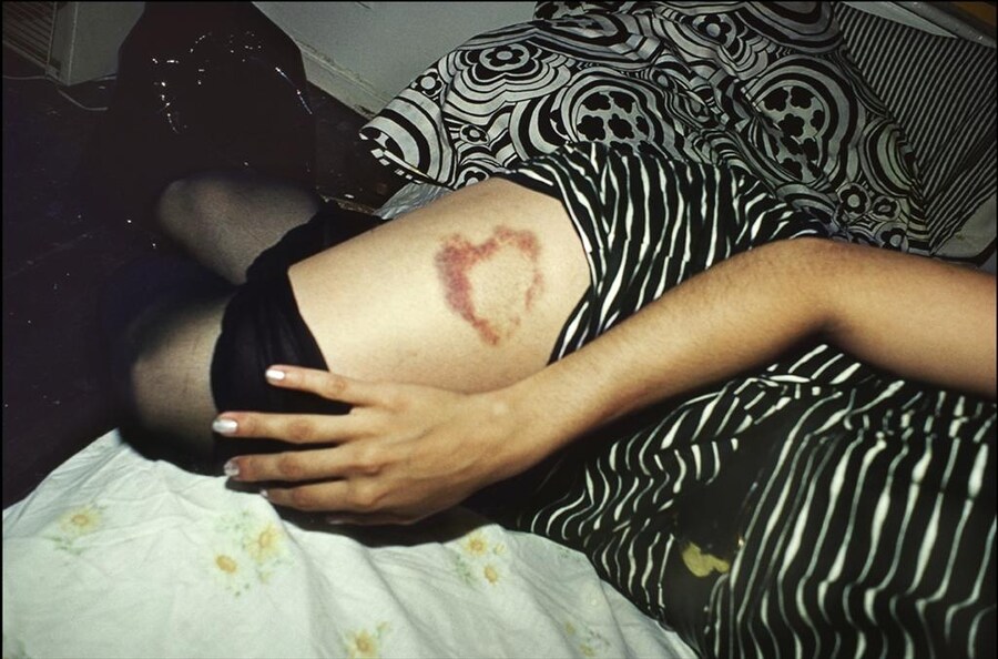 Heart-shaped Bruise, NYC, 1980