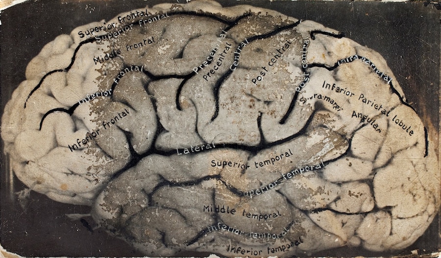 Box model of the brain