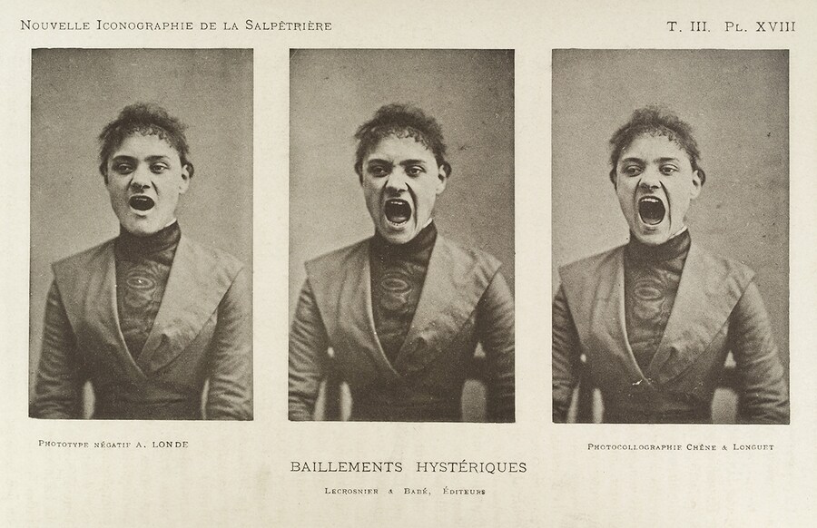 Series of three photos showing a hysterical yawning woman