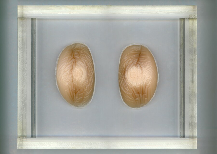 46 - SILICONE OBJECTS ENCASED IN PLEXI 