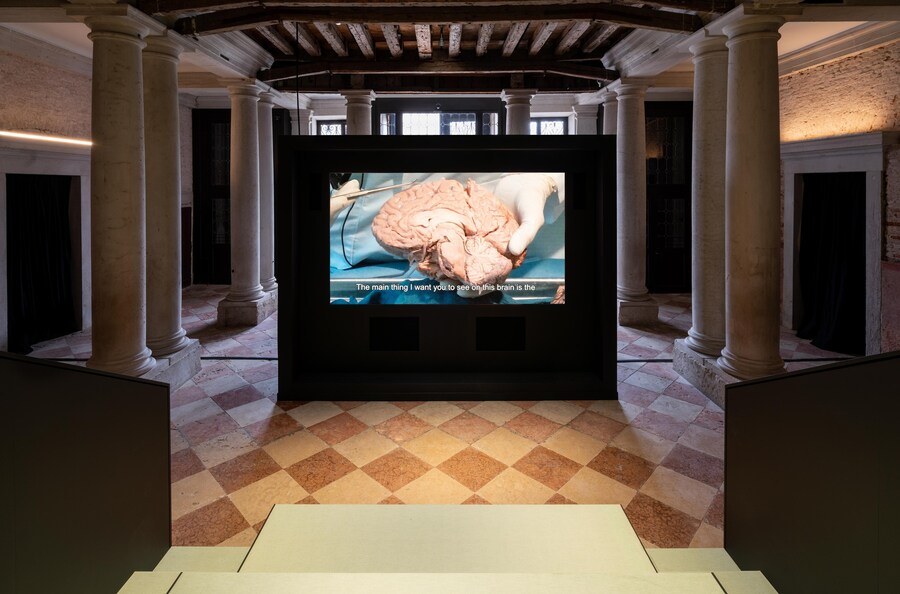 Fondazione Prada Venezia - Human Brains - Ph Marco