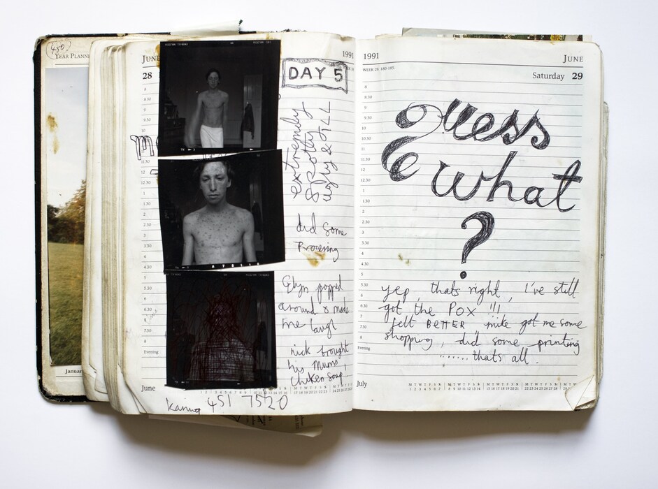 chickenpox self portrait diary page 1991